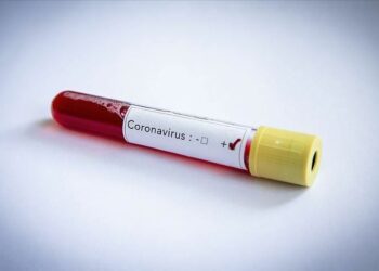 Côte d’Ivoire/Coronavirus: les détails sur l’ivoirien contaminé