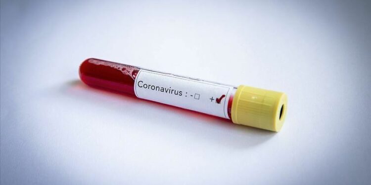 Côte d’Ivoire/Coronavirus: les détails sur l’ivoirien contaminé
