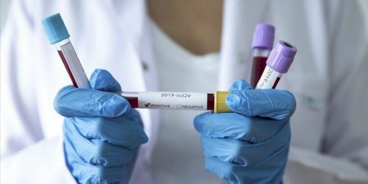 La Côte d’Ivoire enregistre son premier cas de coronavirus