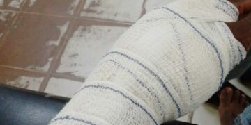 Bouaké: Un joueur blessé à coups de machette par des enfants en conflit avec la loi