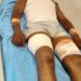 Toumodi: Un mort, une fillette et un policier blessés