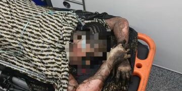 Cocody-Angré : cinq jeunes filles périssent dans un incendie